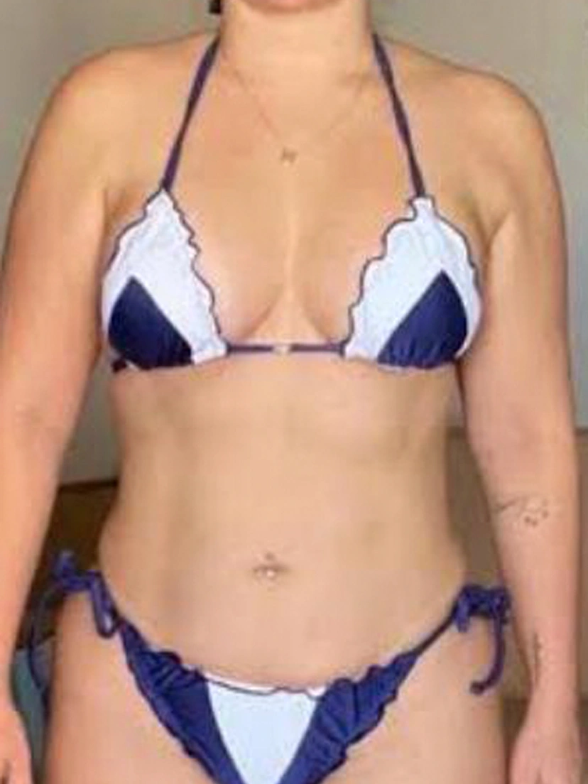 Antes e depois 1