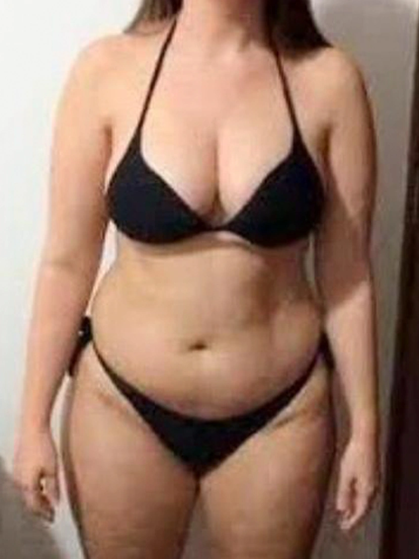 Antes e depois 1