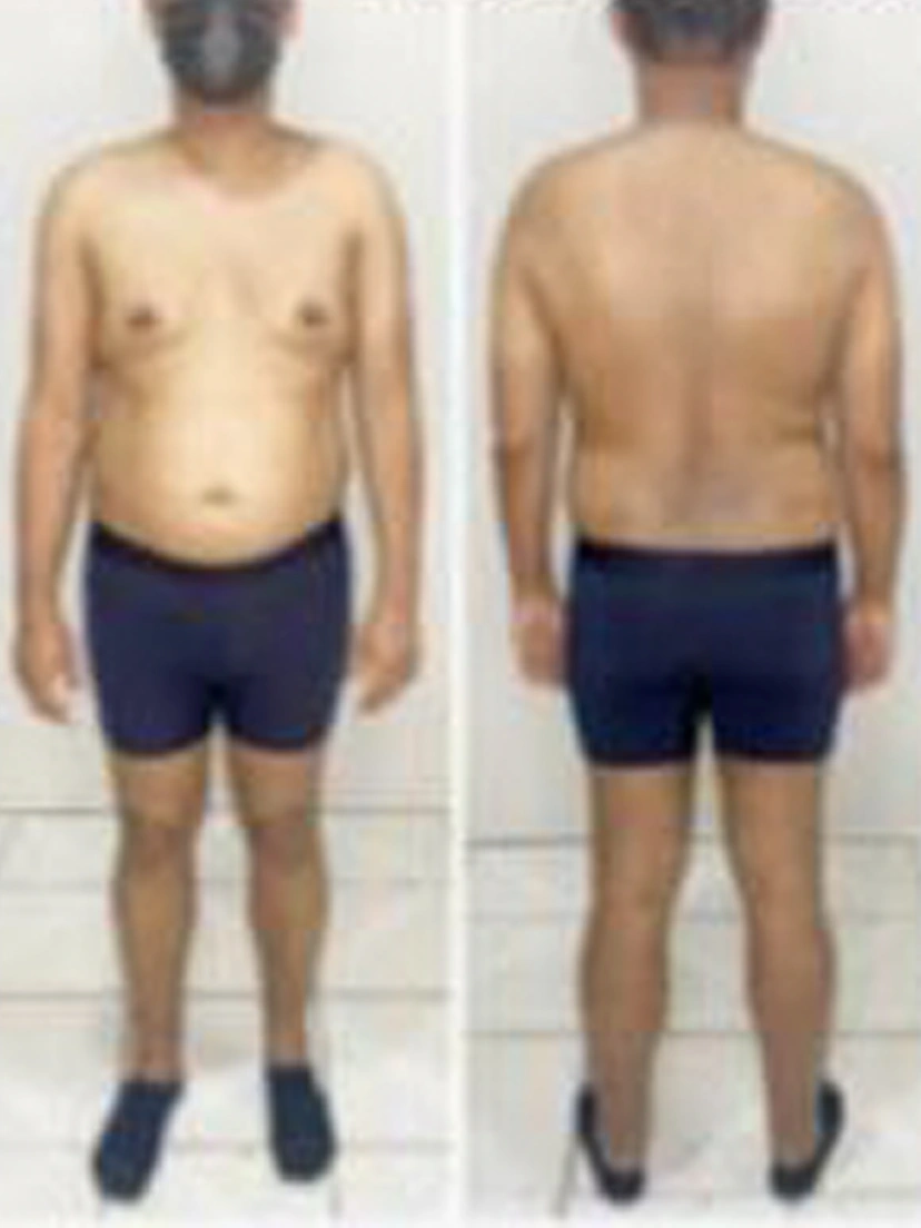 Antes e depois 1