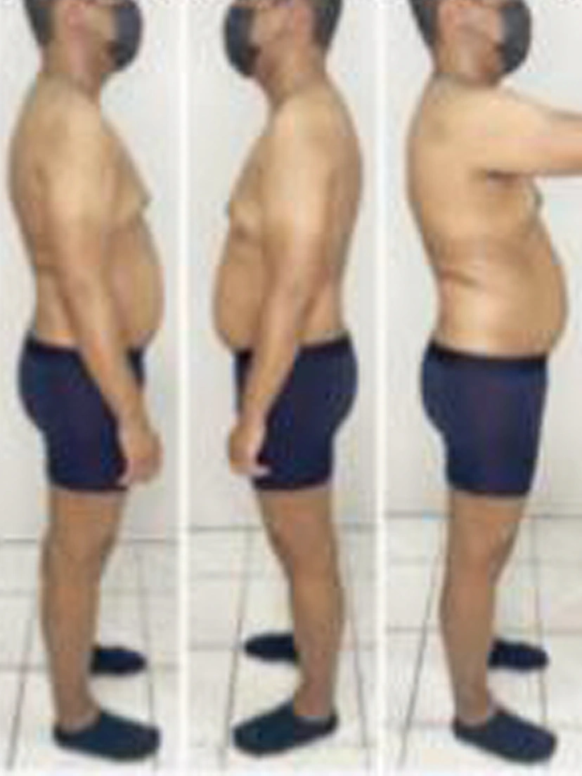 Antes e depois 1