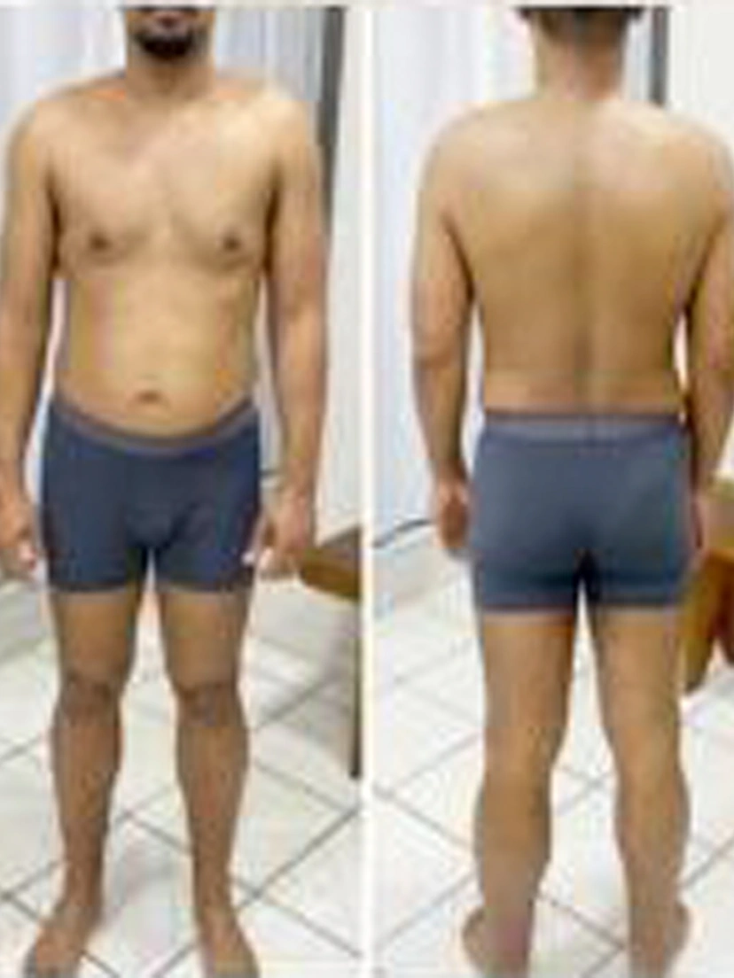 Antes e depois 1