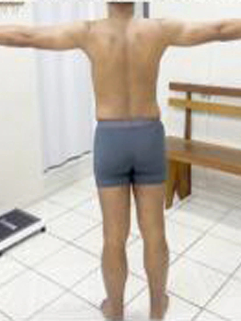Antes e depois 1